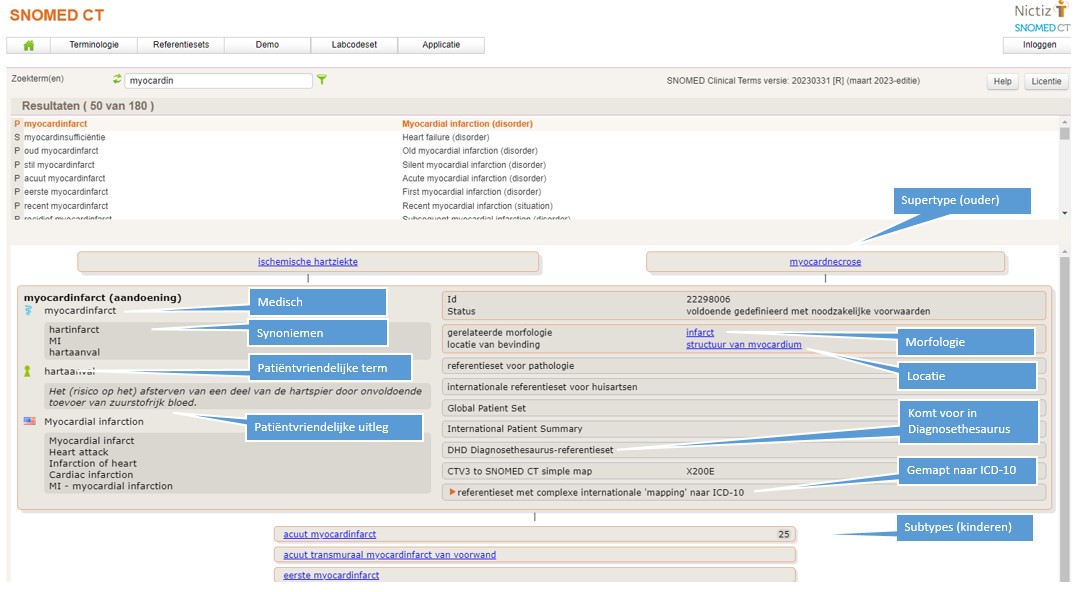 Screenshot als voorbeeld van de polyhiërarchische opbouw van Snomed CT